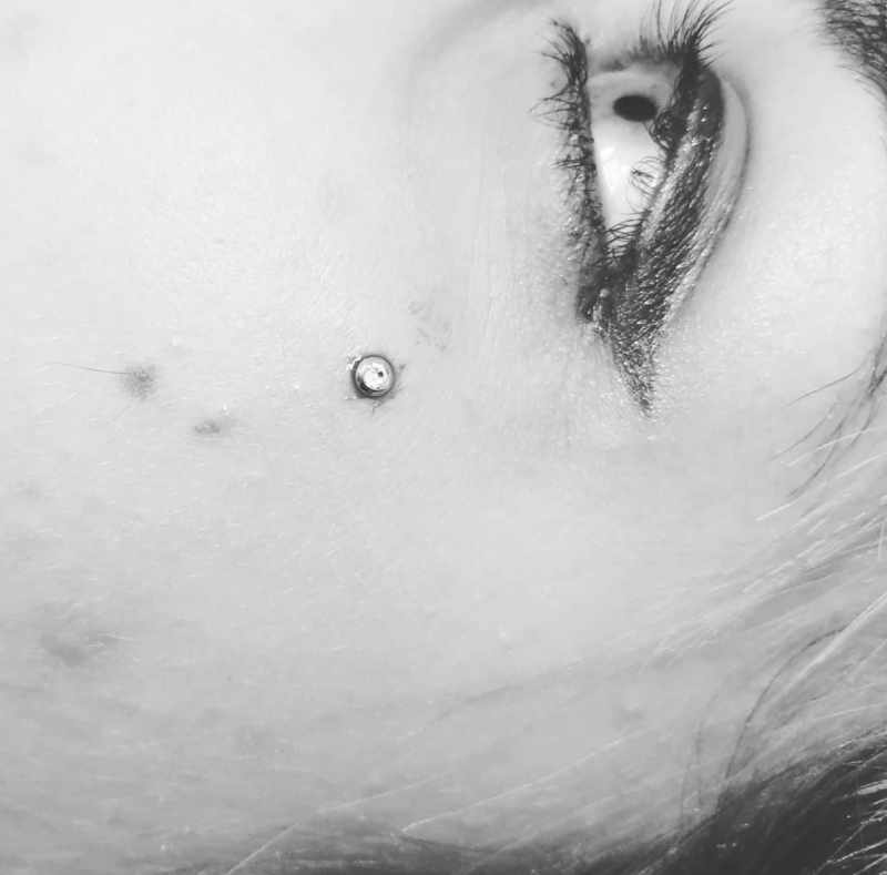 piercing dermal